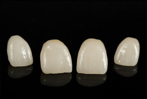 Porcellana CAD/CAM fusa a zirconia per il restauro di aspetto naturale