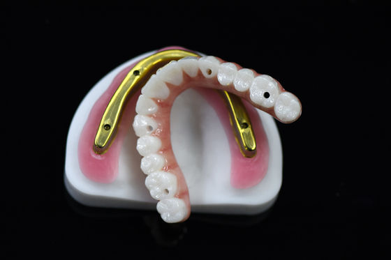 Ponte di zirconia dentale personalizzabile su barra di impianto fresata Alta precisione
