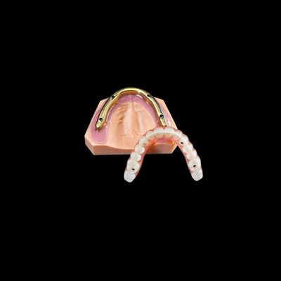 Ponte di zirconia dentale personalizzabile su barra di impianto fresata Alta precisione