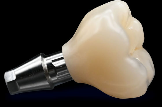 comprare CAD / CAM Impianto Corona Ponte Alta estetica Corona di zirconia online manufacture