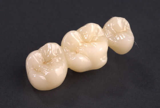 comprare Precise Fit Full Contour Ponte di zircone Ponte di corona di zircone naturale Alta resistenza online manufacture