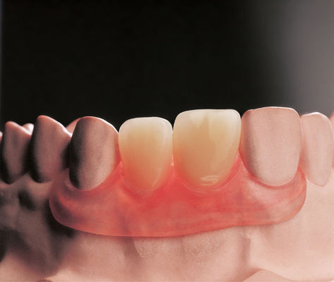 comprare Denti rimovibili a pinne flessibili Protesi parziale clinica rimovibile online manufacture