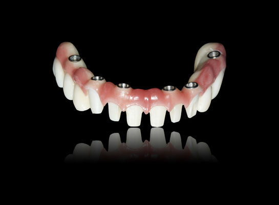 comprare Tutti su X Implantazione Ponte di zirconia Implantazione Ponte di corona Aspetto naturale online manufacture