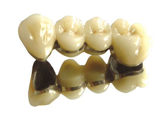 comprare Corona e ponte in lega nobile bianca Corona e ponte in metallo prezioso online manufacture