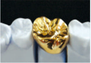 comprare Corone e ponte in metallo giallo Leghe preziose Corone e ponte personalizzabile online manufacture