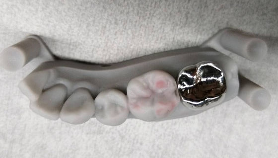 comprare Implantazione di corona non preziosa in metallo PFM Crown And Bridge Professional online manufacture