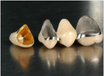 comprare Nobile corona di leghe preziose e ponte corona gialla provvisoria online manufacture