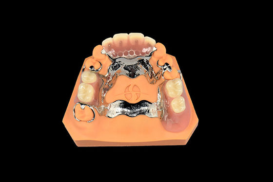 comprare Impianti dentali Protesi estraibili Protesi parziale in metallo Vitallium online manufacture