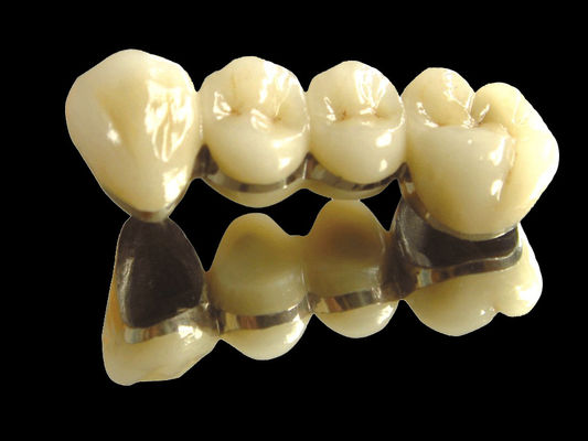 comprare Implantazione di ponte in metallo prezioso ponte corona resistente all'usura personalizzato online manufacture