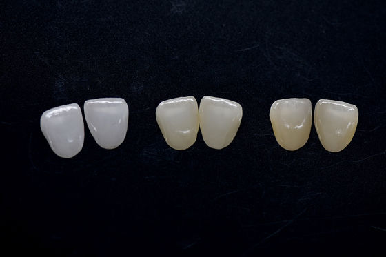 comprare Veneer di zirconia altamente estetico Veneer di zirconia Emax duraturi online manufacture