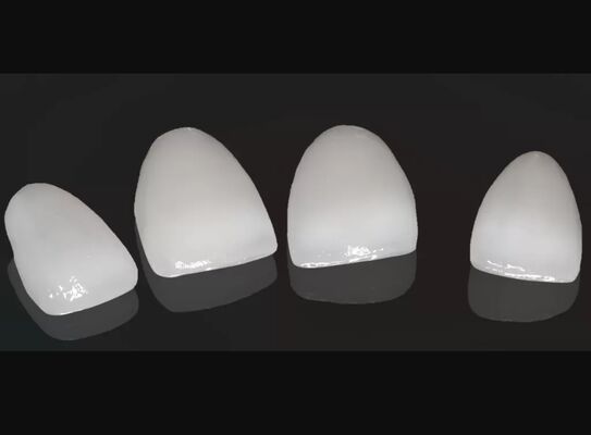 comprare Alta estetica corona composita Onlay Veneer Dimensioni personalizzabili online manufacture