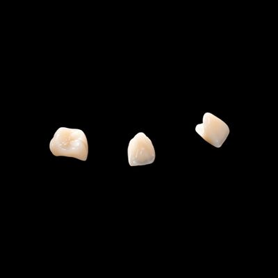 comprare Porcellana CAD/CAM fusa a zirconia per il restauro di aspetto naturale online manufacture