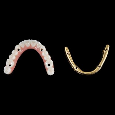 comprare Personalizza gli impianti dentali ibridi Protesi ibrida con barra di titanio online manufacture