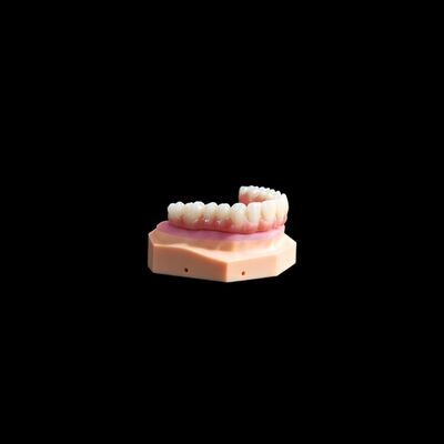 comprare Tutti su X Impianto di Titanio Dental Bridge con Composite Accurate online manufacture