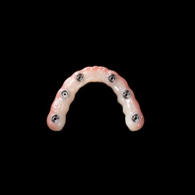 comprare Impianto di denti artificiali a carico immediato denti artificiali rimovibili rosa chiaro online manufacture