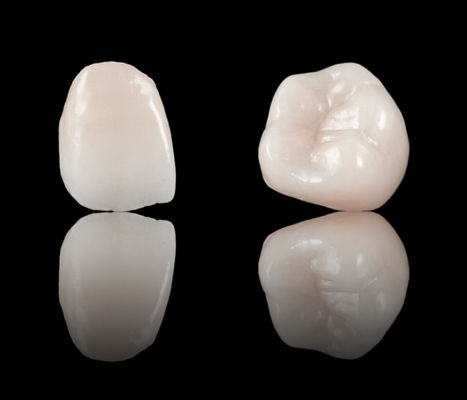 Alta estetica Corona dentale a contorno completo Ponte circonia CE e FDA approvazione