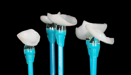 EMAX Pressa Onlay Veneer Alta precisione Veneer dentale Ottima vestibilità