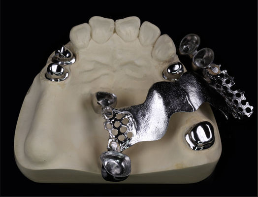 Telescopio corona e ponte di metallo per denti e ortodonzia