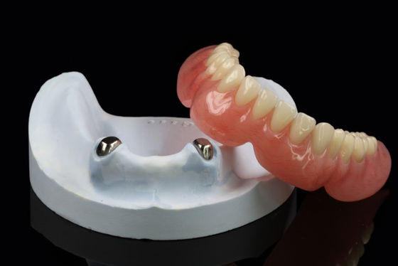 Denti rimovibili da telescopio Precisione Attachment Dentiera sovradentata Arylic