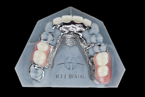 Quadro in metallo di titanio Protesi removibile denti falsi personalizzati