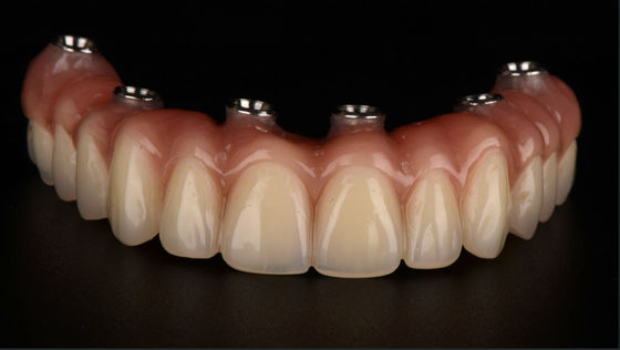 All On X Protesi dentarie a supporto di impianto Titanio ponte dentale CE FDA approvazione