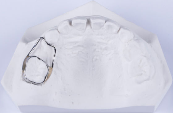 Ritenitore di spazio dentale personalizzabile per i denti Ritenitore per fissare il gap