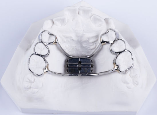 Espansivo del palato dentale bidirezionale fisso