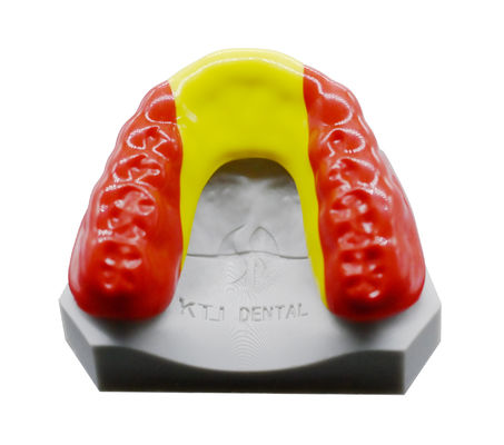 Protezione orale sportiva personalizzabile Ortodonzia Apparecchiatura Protezione orale professionale