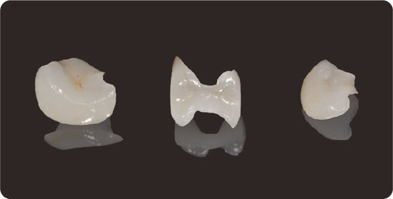 Precisione Infissi e infissi dentali Litio dissilicato fresatura Infissi di finitura