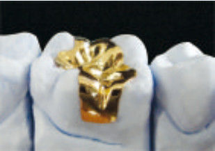 Infissi ed infissi in oro dental eccellenti.