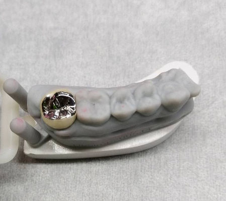 Corona di metallo di lega semi-preziosa e dente ponte Corona temporanea