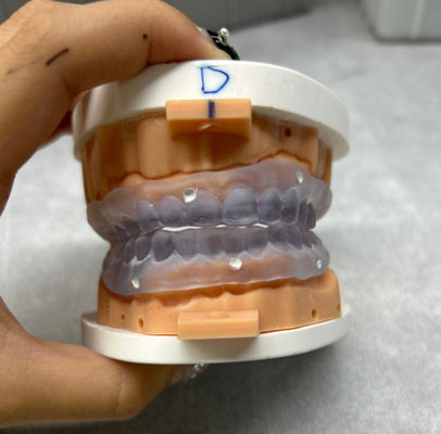 Dentiere stampate in 3D personalizzabili Prova in digitale Dentiera completa