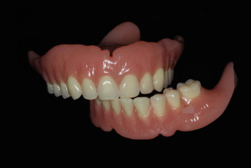 Dentieri stampati completamente rimovibili Dentieri completi digitali rosa