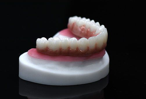 Full Arch Zirconia Hybrid Bridge Zirconia Crown Bridge Personalizzato