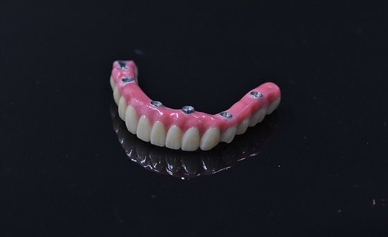 Impianto di denti artificiali a carico immediato denti artificiali rimovibili rosa chiaro