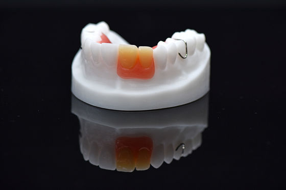 Dentiera rimovibile con pinna acrilica Dentiera acrilica rimovibile personalizzata