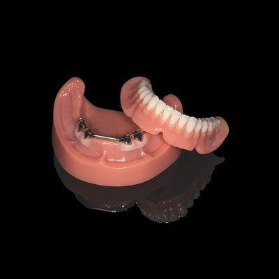 Denti rimovibili a barra di titanio rosa con finitura a dentiera acrilica