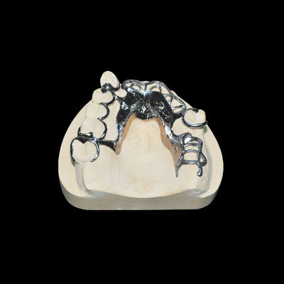 Alte precisione Vitallium Framework Protesi dentale rimovibile Classe 2