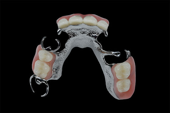 Denti rimovibili personalizzabili Cornice in titanio Cornice in metallo dentale