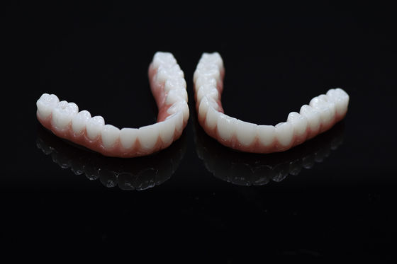 Tutti su X Impianto di Titanio Dental Bridge con Composite Accurate