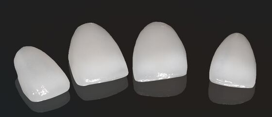 Alta estetica corona composita Onlay Veneer Dimensioni personalizzabili